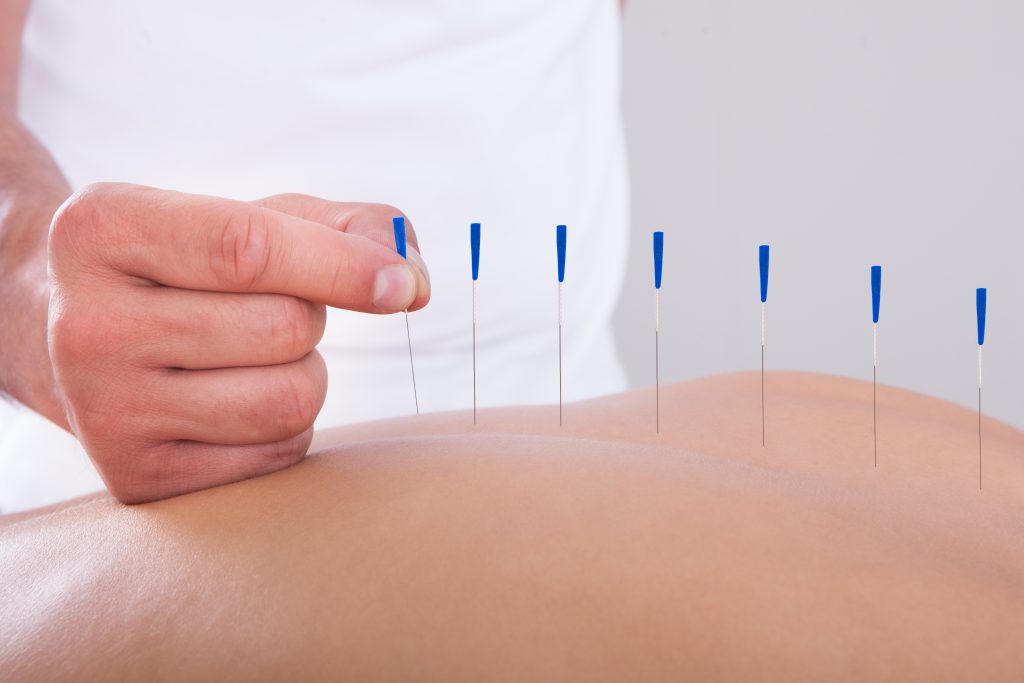 Akupunktur bidrar til å gjenopprette energibalansen i kroppen og stimulere til selvhelbredelse.